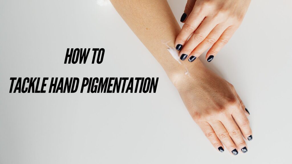HOW TO TACKLE HAND PIGMENTATION