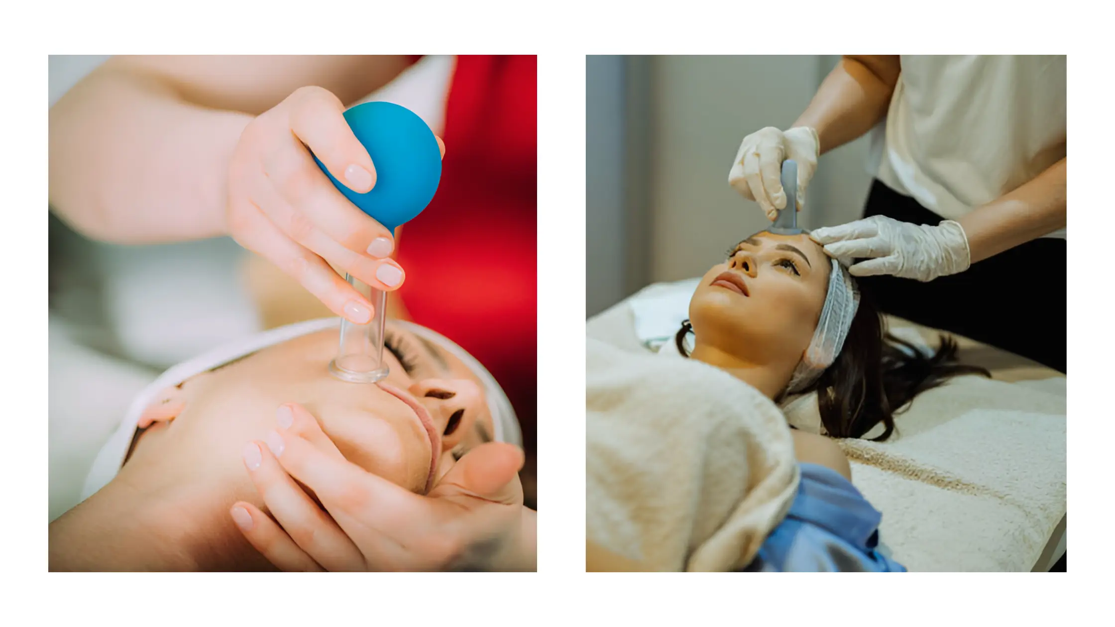 Is Facial Cupping Safe for Every Skin Type? Precautions You Should Know! 13 Facial Cupping Skin Types