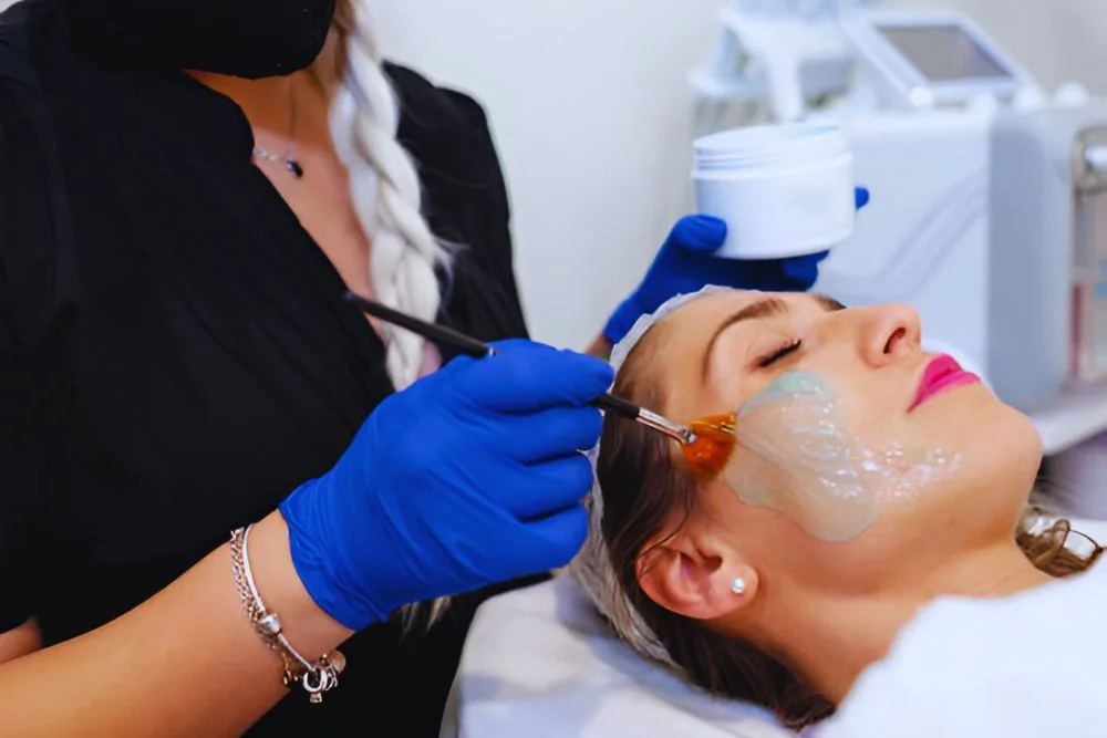 Chemical Peeling 6 Chemical peeling