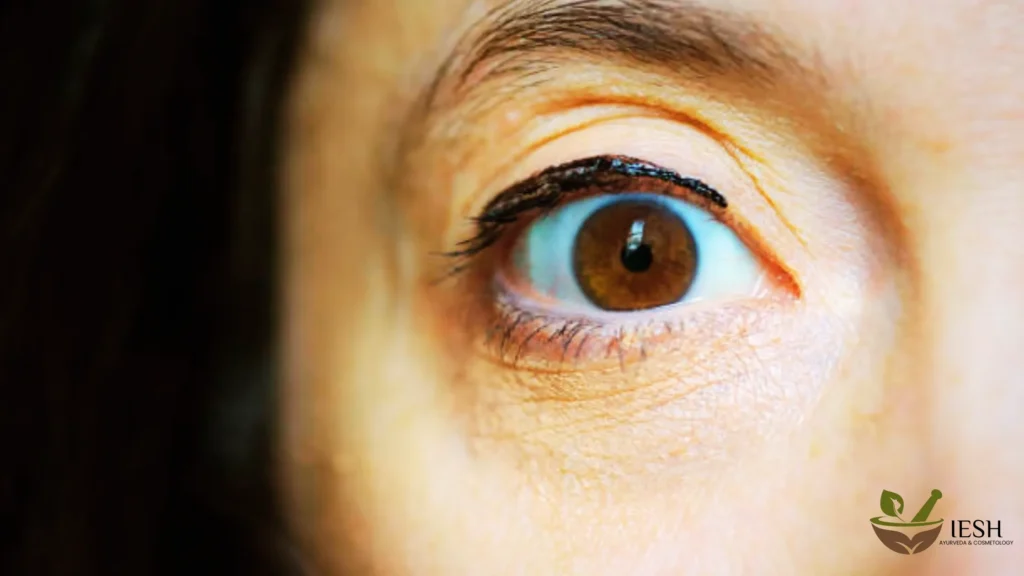 Get Rid of Fine Lines & Wrinkles