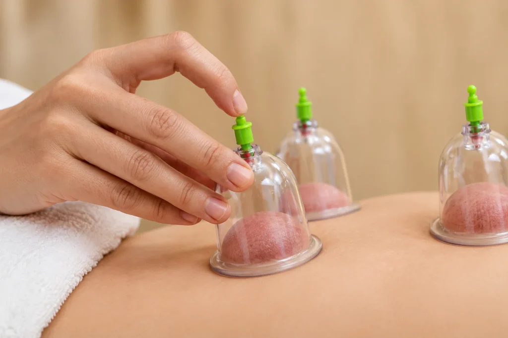 Cupping Therapy in Thrissur & Calicut