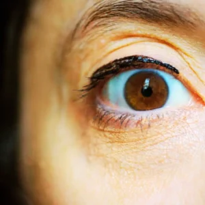 Get Rid of Fine Lines & Wrinkles