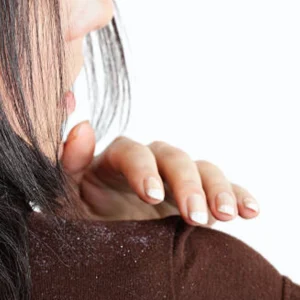 Hair Care Routine For Dandruff